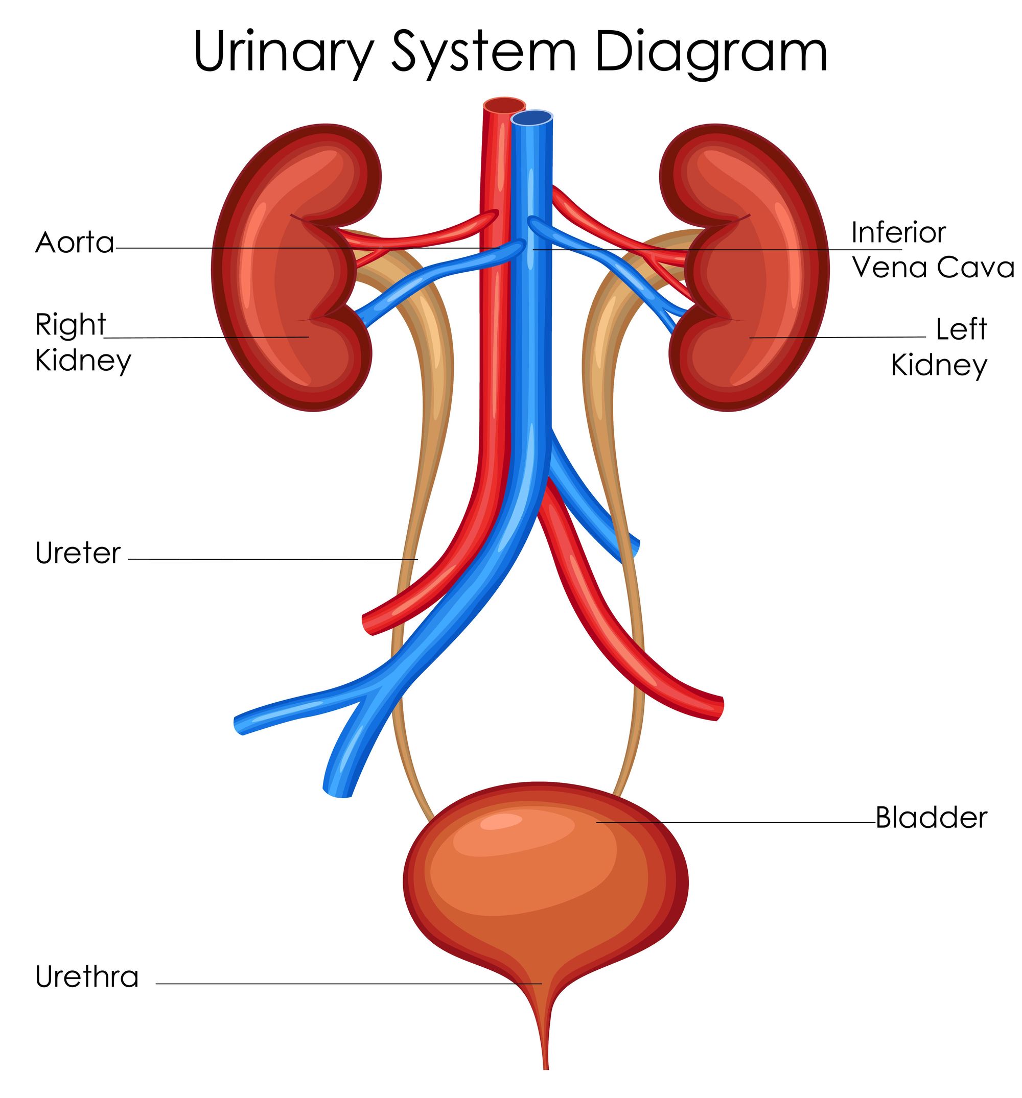 A diagram of the urinary system, showing the different types of urinary incontinence