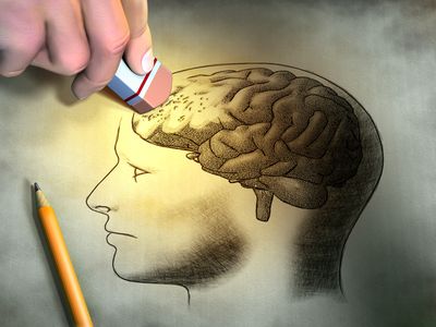 Loss of Memory- Signs of Dementia?