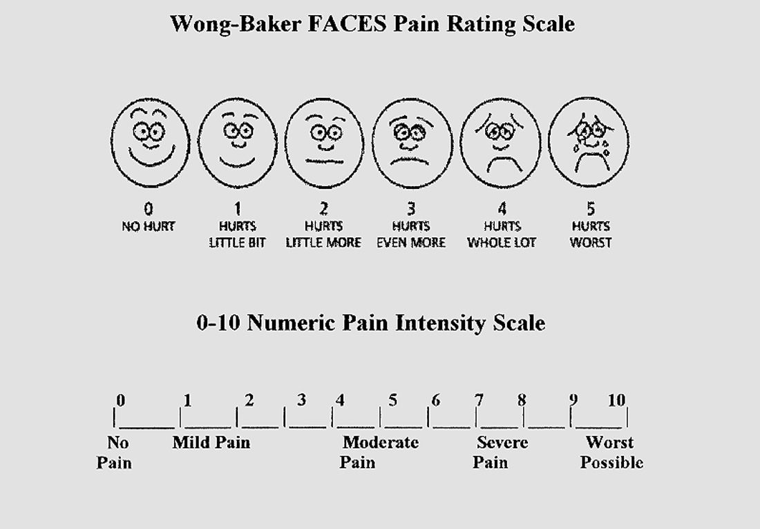 Pain Levels 1 to 10, Different Pain Thresholds