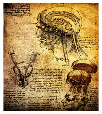 Subcortical Dementia Syndrome-Binswanger's Disease