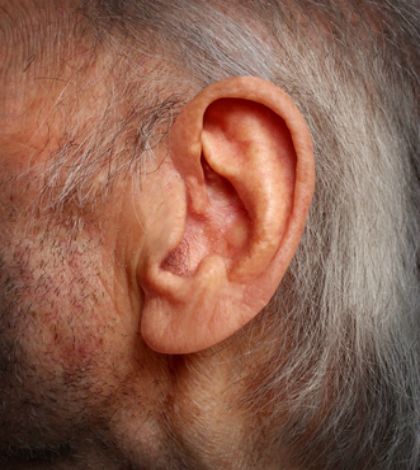 Hearing Loss and Dementia: Is there a Connection?